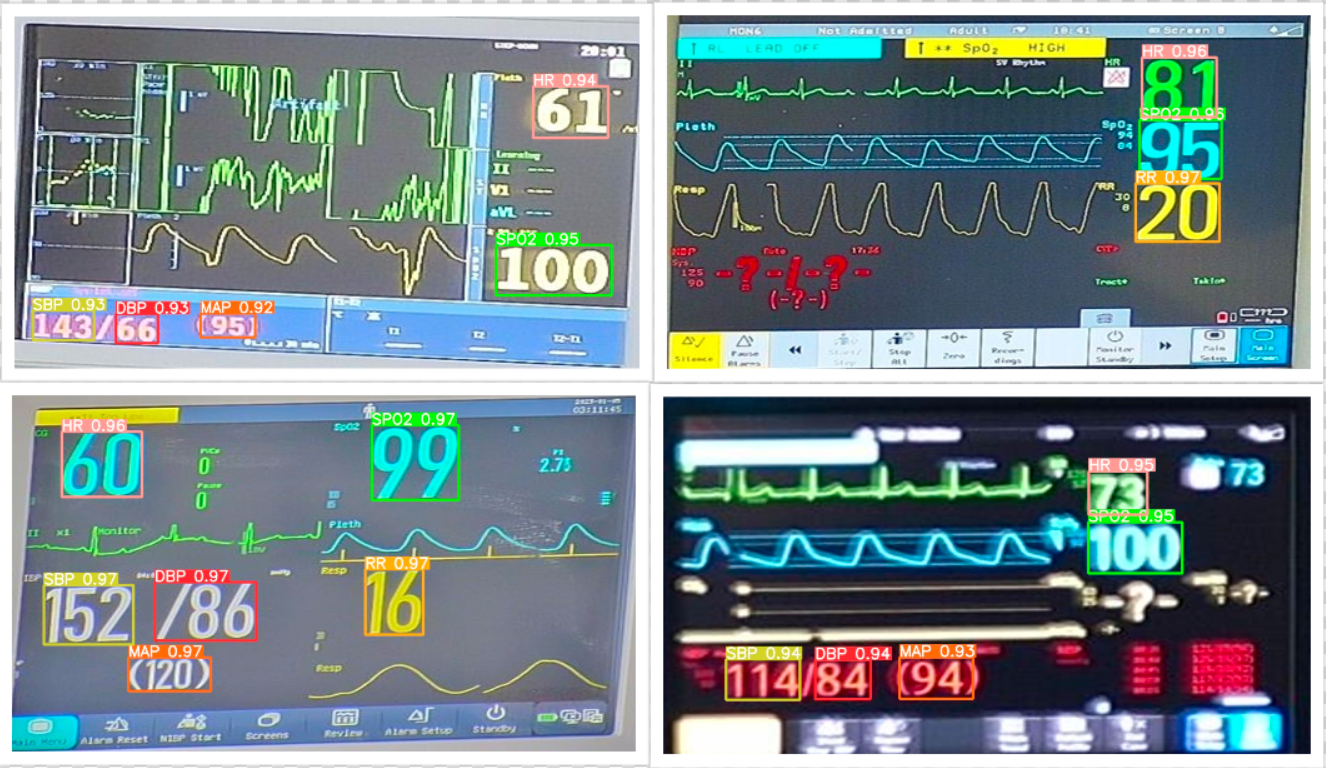 vitals